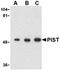 Golgi Associated PDZ And Coiled-Coil Motif Containing antibody, ADI-905-724-100, Enzo Life Sciences, Western Blot image 