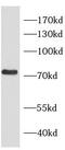 Ras Homolog Family Member T2 antibody, FNab07287, FineTest, Immunohistochemistry frozen image 