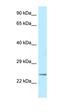 Kazrin, Periplakin Interacting Protein antibody, orb326412, Biorbyt, Western Blot image 