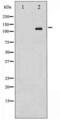 ABL Proto-Oncogene 1, Non-Receptor Tyrosine Kinase antibody, LS-C416421, Lifespan Biosciences, Western Blot image 