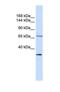 Semaphorin 6D antibody, NBP1-69274, Novus Biologicals, Western Blot image 