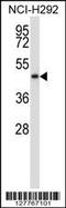 NAD Kinase 2, Mitochondrial antibody, MBS9201006, MyBioSource, Western Blot image 