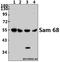 KH RNA Binding Domain Containing, Signal Transduction Associated 1 antibody, A01717Y145, Boster Biological Technology, Western Blot image 