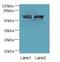 Zinc Finger Protein 215 antibody, LS-C394989, Lifespan Biosciences, Western Blot image 