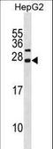 Cyclin Dependent Kinase Inhibitor 3 antibody, LS-C157637, Lifespan Biosciences, Western Blot image 