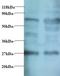 Myelin Protein Zero antibody, LS-C211263, Lifespan Biosciences, Western Blot image 