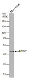 Forkhead Box L2 antibody, GTX100200, GeneTex, Western Blot image 