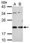 Vasohibin 1 antibody, PA5-30446, Invitrogen Antibodies, Western Blot image 