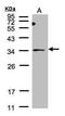 ST3 Beta-Galactoside Alpha-2,3-Sialyltransferase 1 antibody, PA5-21721, Invitrogen Antibodies, Western Blot image 