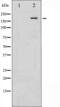 Insulin Receptor Substrate 1 antibody, abx011015, Abbexa, Western Blot image 