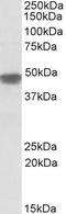 NADH:Ubiquinone Oxidoreductase Core Subunit S2 antibody, EB10189, Everest Biotech, Western Blot image 