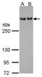 Tumor Protein P53 Binding Protein 1 antibody, GTX102595, GeneTex, Western Blot image 