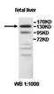 Inverted formin-2 antibody, orb77980, Biorbyt, Western Blot image 