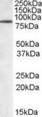 Tripartite Motif Containing 3 antibody, GTX89826, GeneTex, Western Blot image 