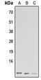 G Protein Subunit Gamma 13 antibody, abx121612, Abbexa, Western Blot image 