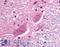 Sodium Voltage-Gated Channel Alpha Subunit 3 antibody, LS-A8068, Lifespan Biosciences, Immunohistochemistry frozen image 