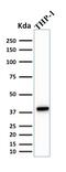 Spi-1 Proto-Oncogene antibody, GTX17997, GeneTex, Western Blot image 