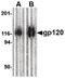 Inter-Alpha-Trypsin Inhibitor Heavy Chain 4 antibody, PA5-20488, Invitrogen Antibodies, Western Blot image 