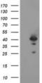 DNA repair protein RAD51 homolog 2 antibody, NBP2-01220, Novus Biologicals, Western Blot image 