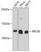 Ribosomal Protein L38 antibody, A10156, Boster Biological Technology, Western Blot image 