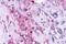 KISS1 Receptor antibody, NLS1927, Novus Biologicals, Immunohistochemistry paraffin image 