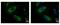 Protein Phosphatase, Mg2+/Mn2+ Dependent 1A antibody, GTX109744, GeneTex, Immunofluorescence image 