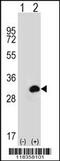 Carbonic Anhydrase 1 antibody, 56-562, ProSci, Western Blot image 