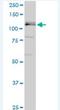 GLI Family Zinc Finger 1 antibody, H00002735-M21-100ug, Novus Biologicals, Western Blot image 