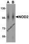 Nucleotide Binding Oligomerization Domain Containing 2 antibody, 2511, ProSci, Western Blot image 