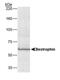 Bestrophin 1 antibody, MA1-91895, Invitrogen Antibodies, Western Blot image 