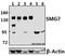 SMG7 Nonsense Mediated MRNA Decay Factor antibody, A06078-1, Boster Biological Technology, Western Blot image 