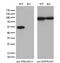 Protein Kinase CAMP-Dependent Type II Regulatory Subunit Alpha antibody, GTX83823, GeneTex, Western Blot image 