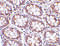 Metalloreductase STEAP2 antibody, 4307, ProSci, Immunohistochemistry paraffin image 