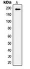 Insulin Receptor Substrate 1 antibody, GTX32201, GeneTex, Western Blot image 
