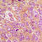 Inhibitor Of Nuclear Factor Kappa B Kinase Subunit Beta antibody, LS-C352369, Lifespan Biosciences, Immunohistochemistry frozen image 