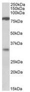 Chloride Channel Accessory 1 antibody, AP31555PU-N, Origene, Western Blot image 