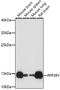 Protein Phosphatase 3 Regulatory Subunit B, Alpha antibody, 13-333, ProSci, Immunohistochemistry frozen image 