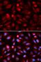 Acid Phosphatase 5, Tartrate Resistant antibody, orb153703, Biorbyt, Immunocytochemistry image 