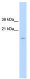 Centromere Protein A antibody, TA338983, Origene, Western Blot image 