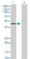 Transcriptional Adaptor 3 antibody, H00010474-M02, Novus Biologicals, Western Blot image 