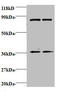 Heterogeneous Nuclear Ribonucleoprotein H1 antibody, A51825-100, Epigentek, Western Blot image 