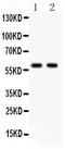 Nuclear Receptor Coactivator 1 antibody, LS-C357604, Lifespan Biosciences, Western Blot image 