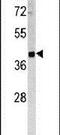 Tumor Associated Calcium Signal Transducer 2 antibody, PA5-13638, Invitrogen Antibodies, Western Blot image 