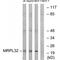 Mitochondrial Ribosomal Protein L14 antibody, PA5-49942, Invitrogen Antibodies, Western Blot image 