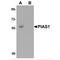 Protein Inhibitor Of Activated STAT 1 antibody, MBS151513, MyBioSource, Western Blot image 