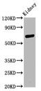 CD2 Associated Protein antibody, CSB-PA004914LA01HU, Cusabio, Western Blot image 