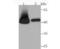 Ribonucleotide Reductase Regulatory Subunit M2 antibody, NBP2-75651, Novus Biologicals, Western Blot image 