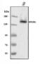 Myocardin Related Transcription Factor A antibody, A32468-2, Boster Biological Technology, Western Blot image 