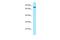 NUAK Family Kinase 1 antibody, A03575, Boster Biological Technology, Western Blot image 