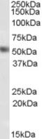 Nuclear Receptor Subfamily 0 Group B Member 1 antibody, LS-C54704, Lifespan Biosciences, Western Blot image 